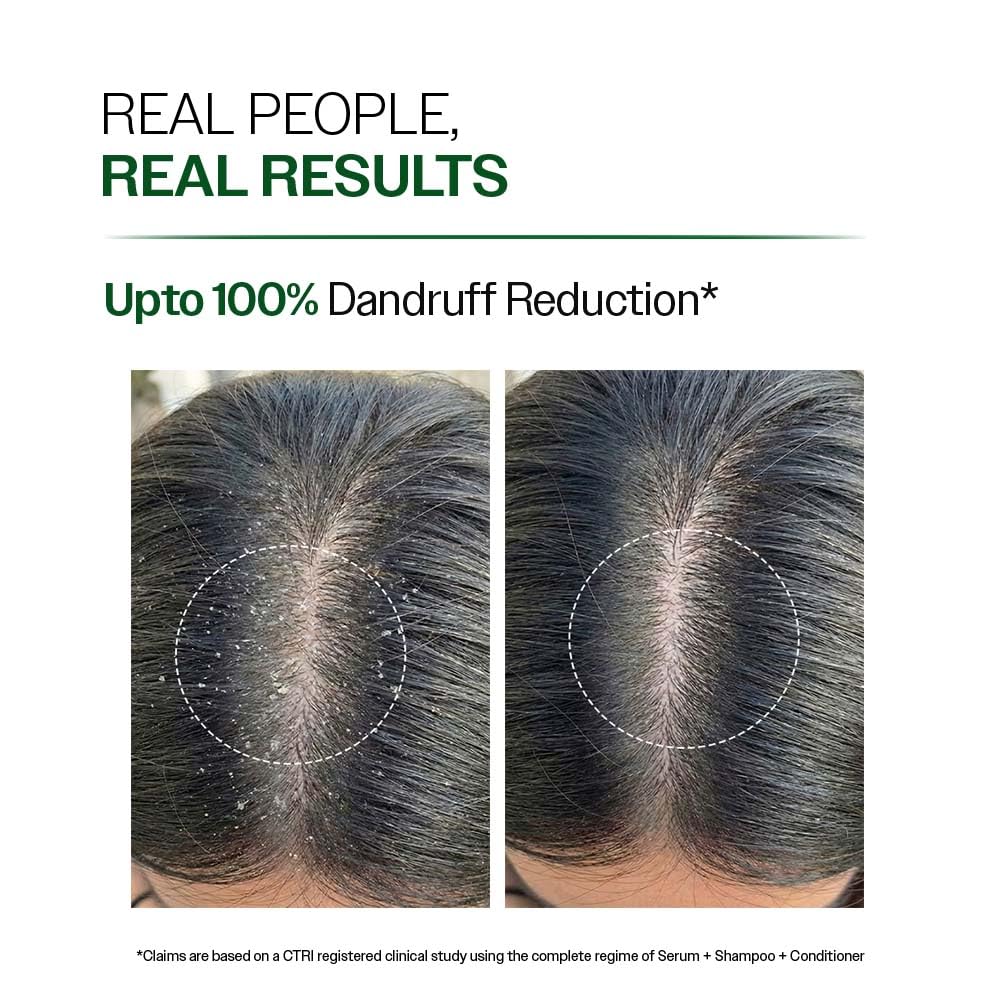 Anti-Dandruff Shampoo | Up To 100% Dandruff Reduction | ZPTO-Free | pH 5.3 | Salicylic Acid, Piroctone Olamine, Biotin & Menthol | Non-Drying Formula | Suitable for Men & Women | 250 ml